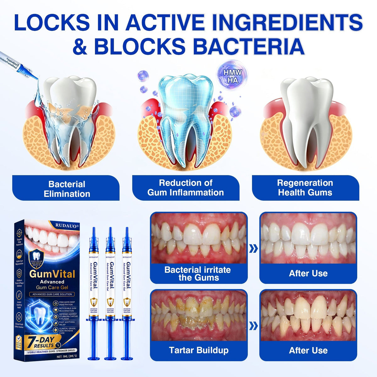 ๐ก๐๐๐๐๐ยฎ๐ฆท GumVital Advanced Gum Care Gel + ๐ FREE Gum Care Kit