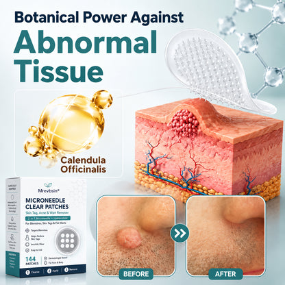 Mrevbsin® Botanical Microneedle Hydrocolloid Patch