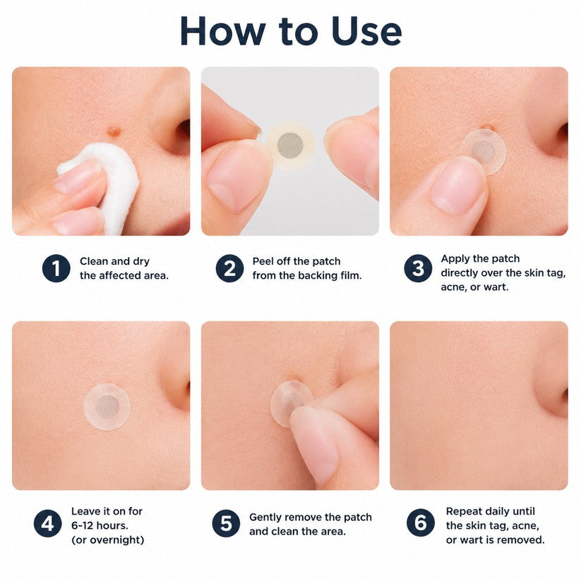 Mrevbsin® Botanical Microneedle Hydrocolloid Patch