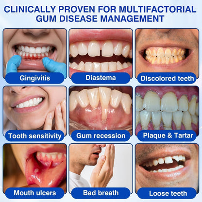 𝓡𝐔𝓓𝐀𝐔𝐎®🦷 GumVital Advanced Gum Care Gel + 🎁 FREE Gum Care Kit