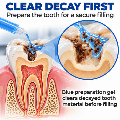 Dr.Fachmer® DentRestore Tooth Repair & Filling System
