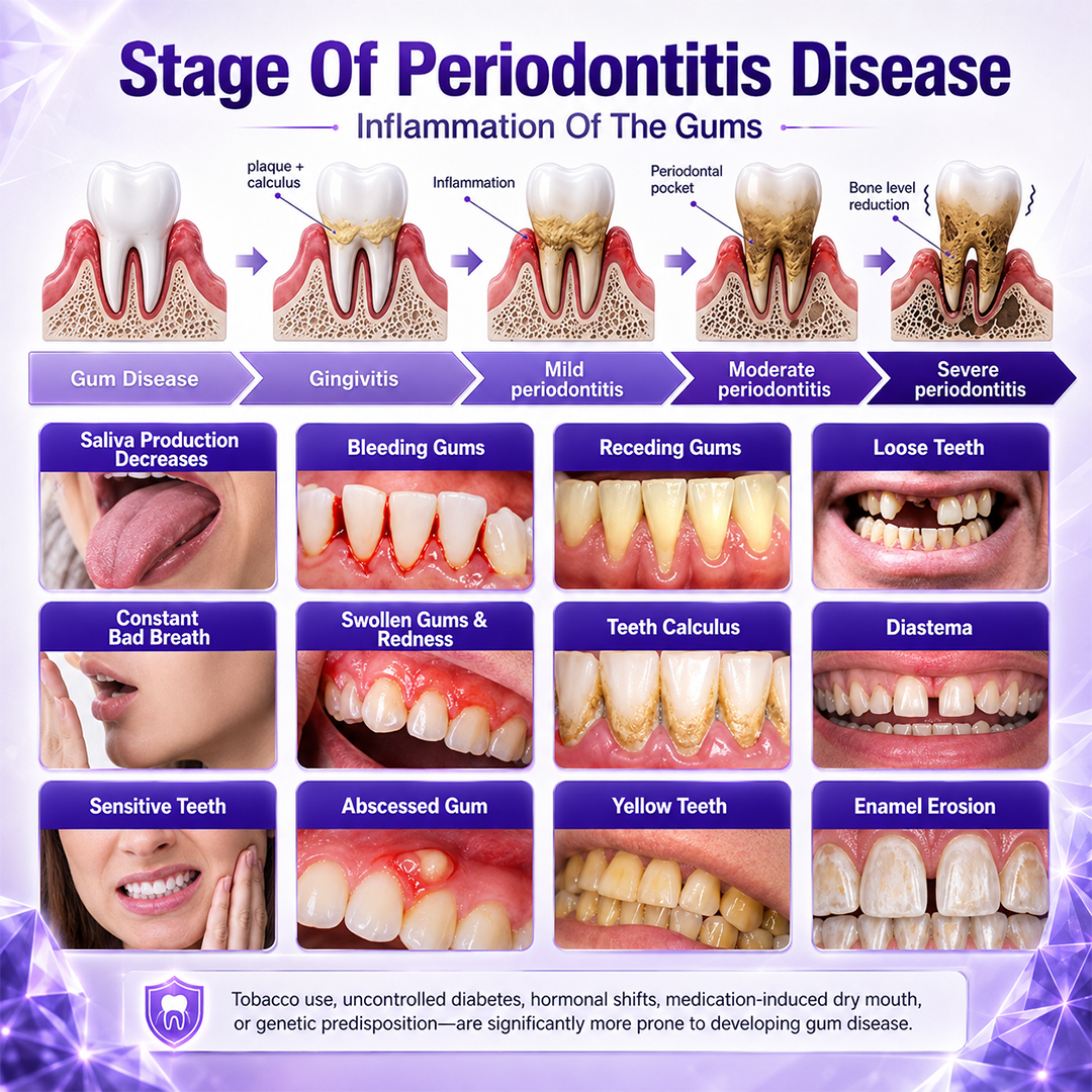 Ceoerty®📢 Gingivitis Periodontal Treatment Toothpaste✨