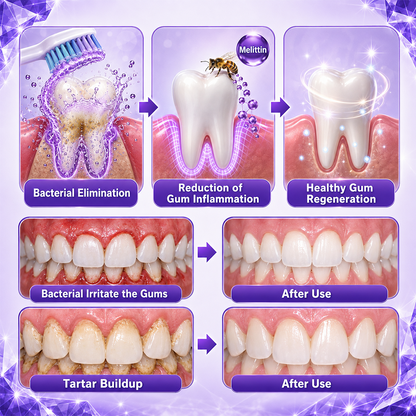 Ceoerty®📢 Gingivitis Periodontal Treatment Toothpaste✨