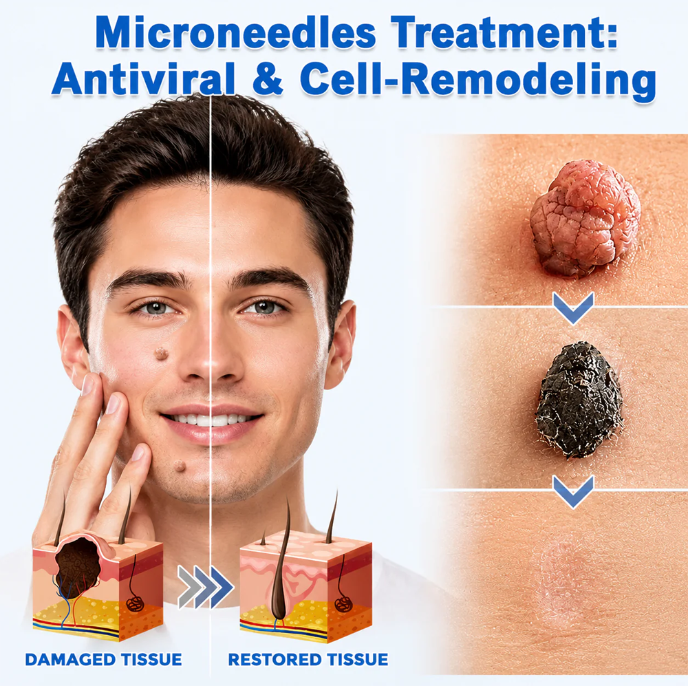 Mrevbsin botanical microneedle hydrocolloid patch