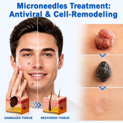 Mrevbsin® Botanical Microneedle Hydrocolloid Patch