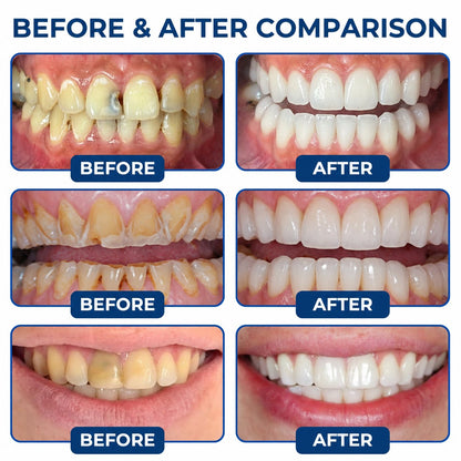 Dr.Fachmer® DentRestore Tooth Repair & Filling System